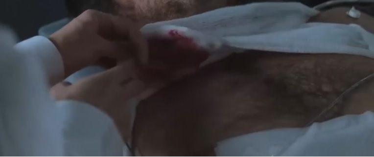 Wolverine is ticklish